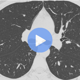 Cardiopulmonary Imaging
