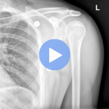 Emergency Imaging: MSK