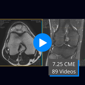 Knee MRI