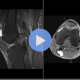 knee mri image from lower extremities conference
