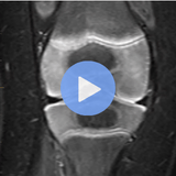 Pediatric MSK Course Image