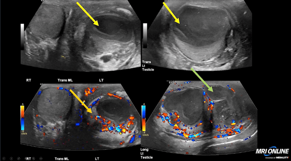 Scrotal imaging case
