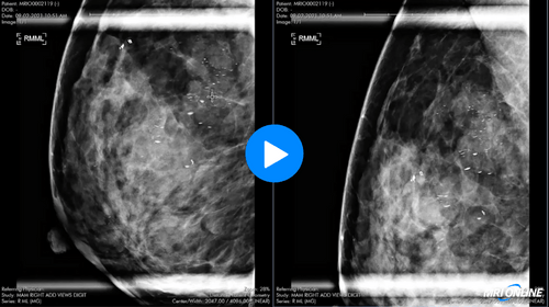 breast diagnostic work up (1)
