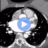 Cardiac CT Fundamentals