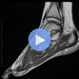 Foot & Ankle MRI