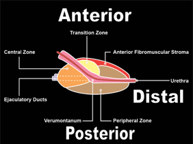 Prostate MRI Reference Guide - PI-RADS version 2
