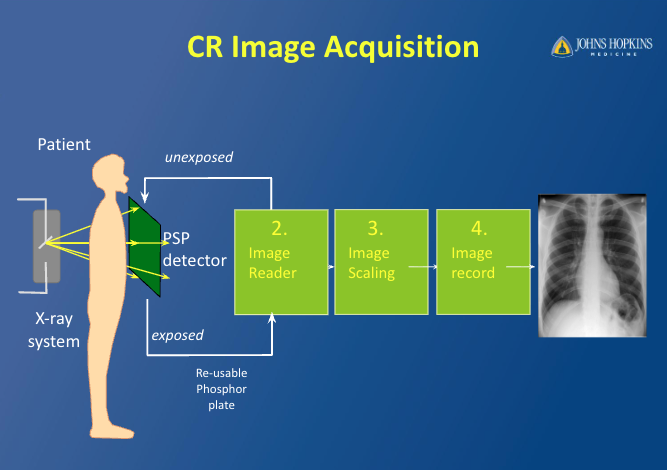 physics - radiographymammography