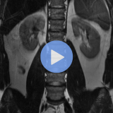 Emergency Neuroimaging: Head, Neck & Spine